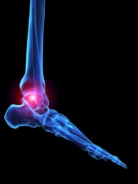 Possible Symptoms of Rheumatoid Arthritis