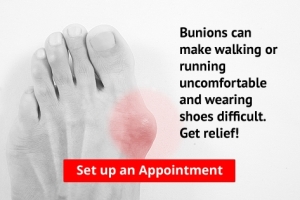 Are Bunions Affecting Your Everyday Life?