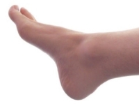 Causes and Relief From Swollen Feet