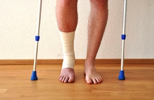 Healing Time Frame for Stress Fractures