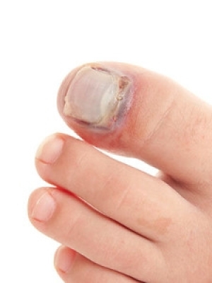 Manchester United defender out with suspected broken toe