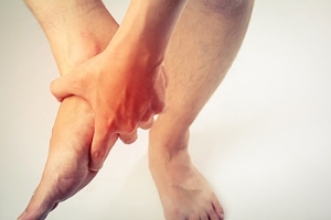 Plantar Fibromatosis