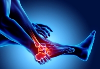 All About Rheumatoid Arthritis