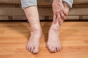 The Elderly Population May Have Foot Conditions