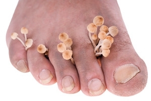 Shower Shoes Help Prevent Foot Infections in Public Showers