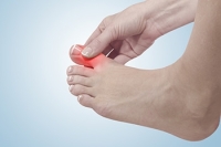 The Relationship Between Gout and Certain Foods