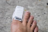How Do Broken Toes Heal?