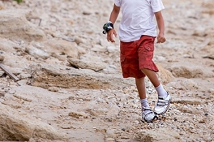 Congenital Foot Deformities and a Focus on Clubfoot